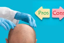 Hair Transplant Graft Calculator vs. Manual Calculation Pros and Cons